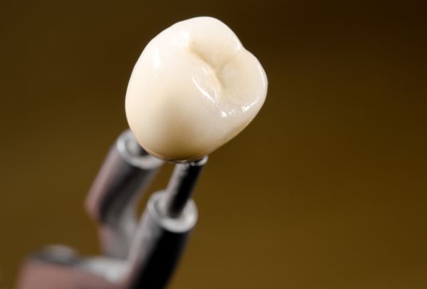 Dental Crowns:   Reasons Why You Need Them