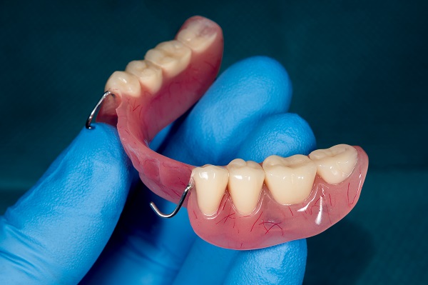 Partial Dentures: A Comprehensive Overview