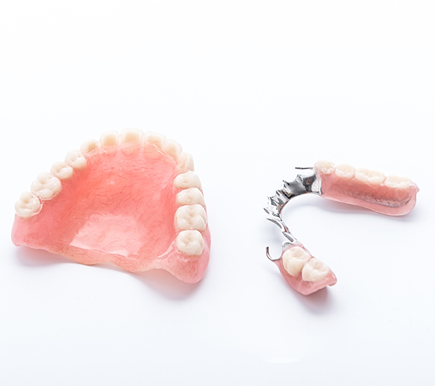 Baton Rouge Partial Dentures for Back Teeth