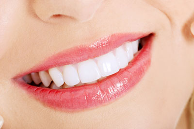 What You Should Know About Teeth Whitening Home Kits