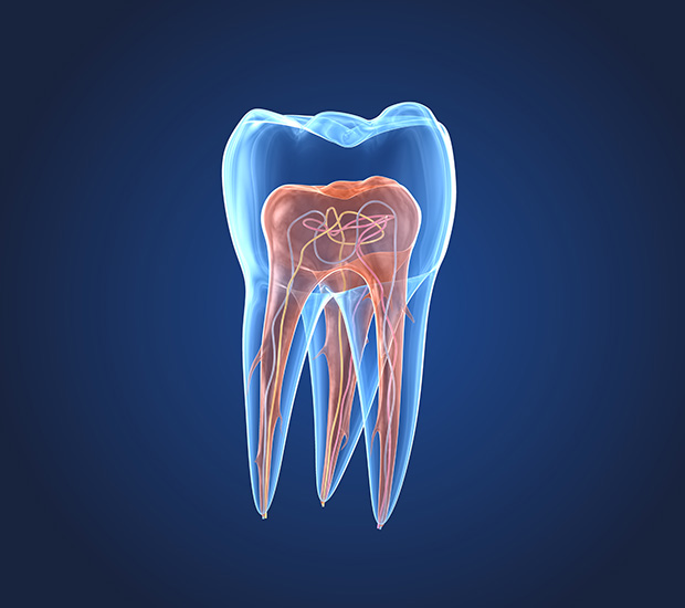 Baton Rouge What is an Endodontist